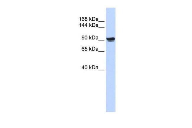 alpha Actinin 1 Antibody in Western Blot (WB)