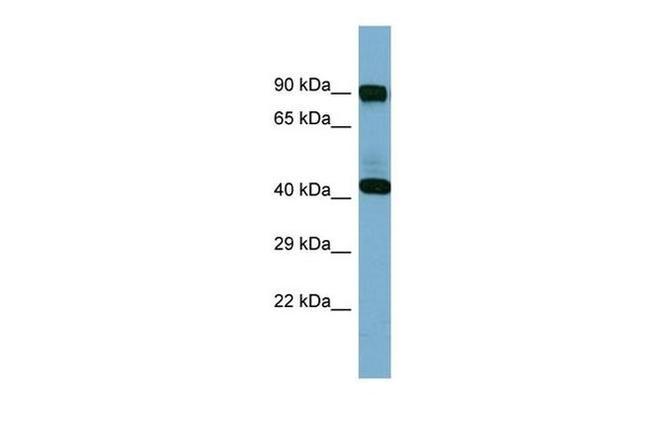 IVD Antibody in Western Blot (WB)