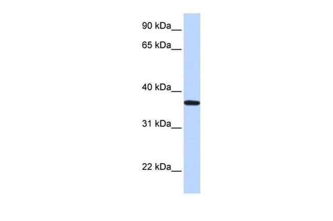 LCN12 Antibody in Western Blot (WB)