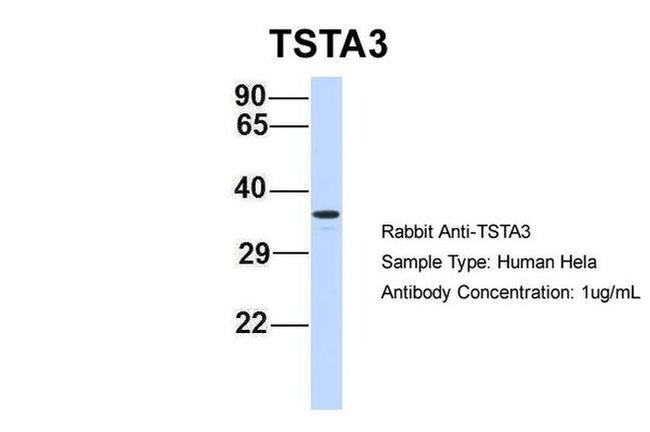 TSTA3 Antibody in Western Blot (WB)