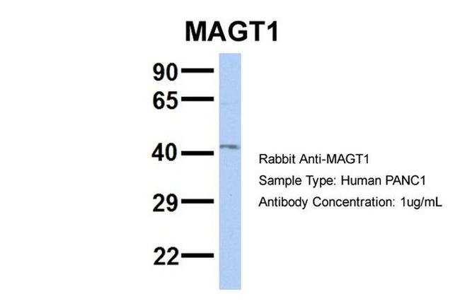 MAGT1 Antibody in Western Blot (WB)