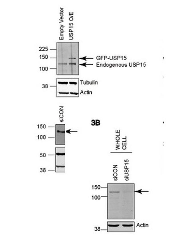 USP15 Antibody in Western Blot (WB)