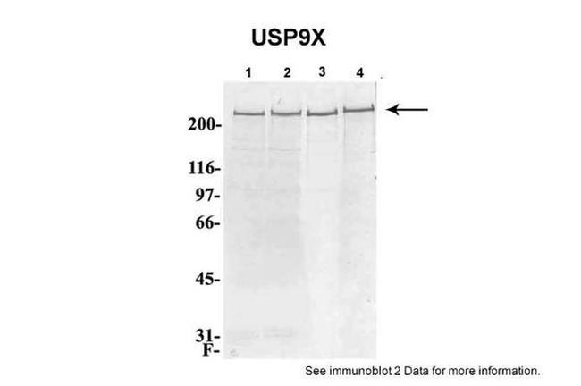 USP9X Antibody in Western Blot (WB)