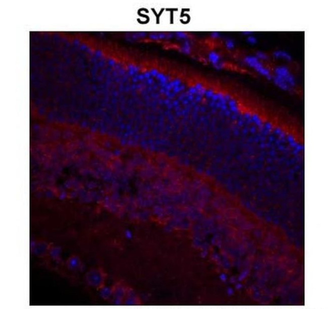 Synaptotagmin 5 Antibody in Immunohistochemistry (IHC)