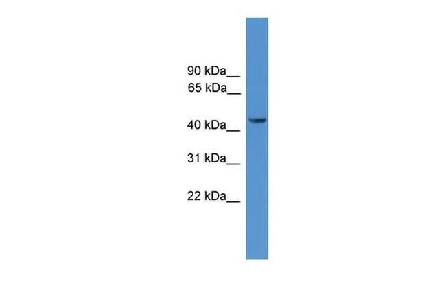 SYT12 Antibody in Western Blot (WB)