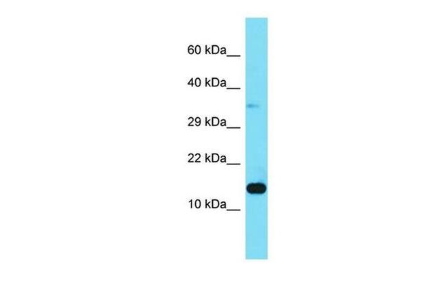 LAMTOR3 Antibody in Western Blot (WB)