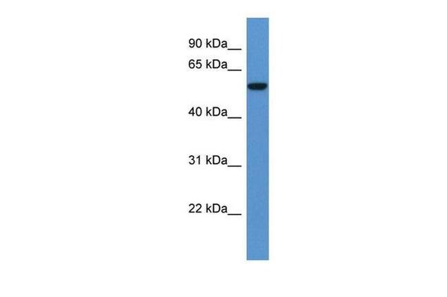 FCAMR Antibody in Western Blot (WB)