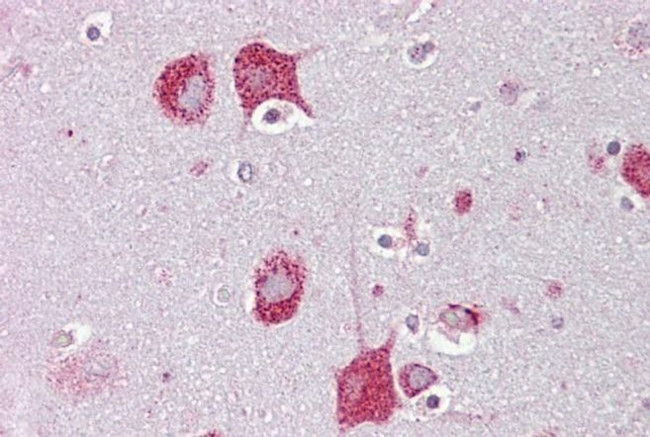 HEXA Antibody in Immunohistochemistry (IHC)