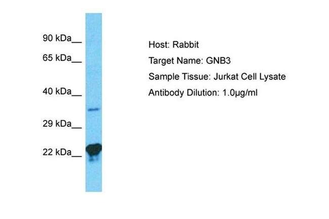 GNB3 Antibody in Western Blot (WB)