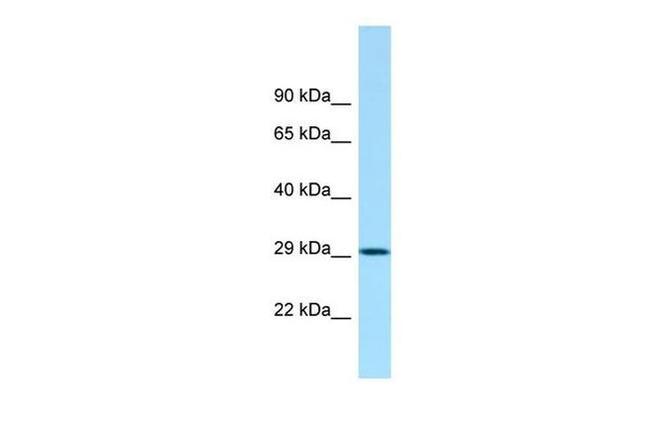 ACY3 Antibody in Western Blot (WB)