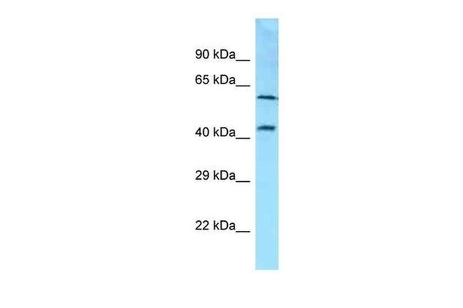 Syndecan 3 Antibody in Western Blot (WB)