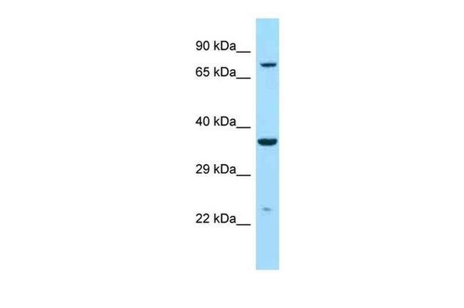 IDUA Antibody in Western Blot (WB)