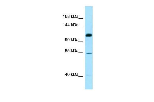 SMC6 Antibody in Western Blot (WB)