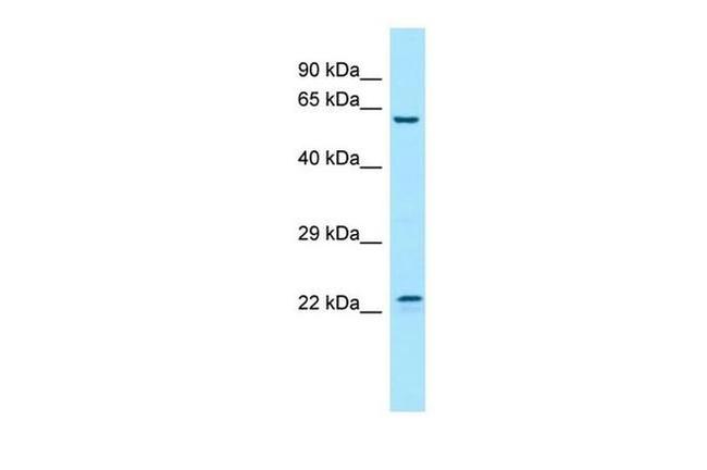 FGF17 Antibody in Western Blot (WB)