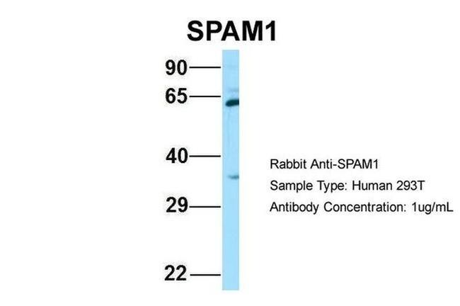 SPAM1 Antibody in Western Blot (WB)