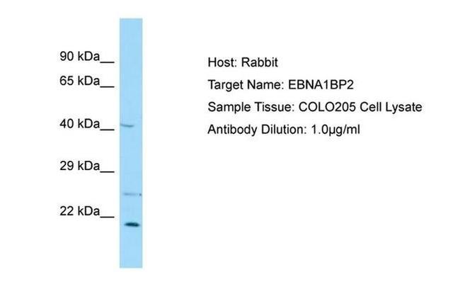 EBNA1BP2 Antibody in Western Blot (WB)