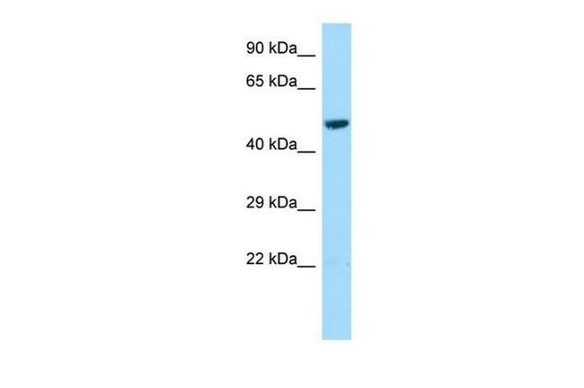 L2HGDH Antibody in Western Blot (WB)