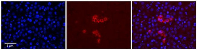 RPS28 Antibody in Immunohistochemistry (Paraffin) (IHC (P))