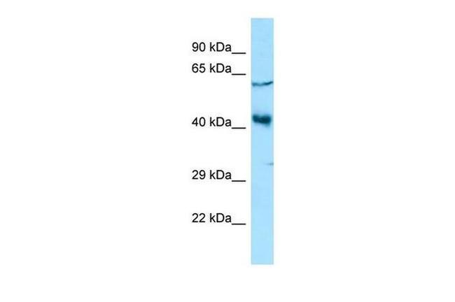 YY2 Antibody in Western Blot (WB)