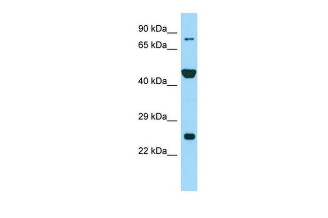 PADI6 Antibody in Western Blot (WB)