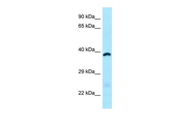 ABHD6 Antibody in Western Blot (WB)