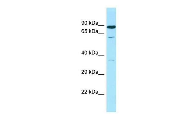 SMOX Antibody in Western Blot (WB)