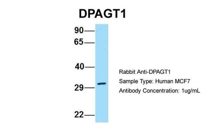 DPAGT1 Antibody in Western Blot (WB)