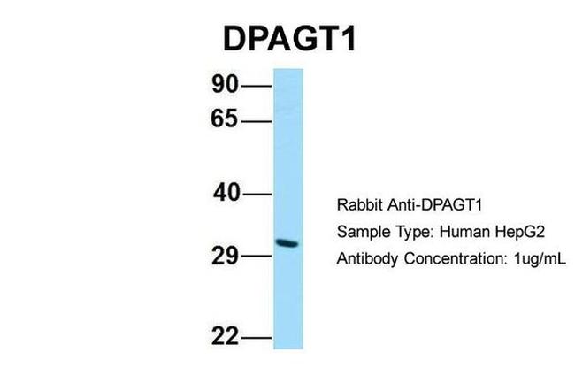 DPAGT1 Antibody in Western Blot (WB)