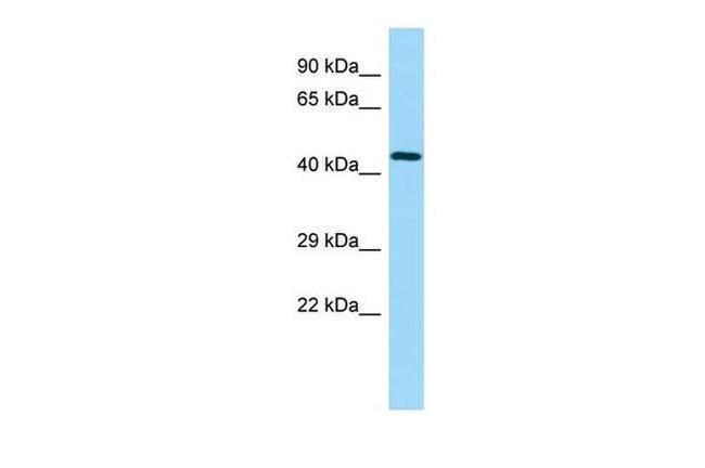 UBE2Q2 Antibody in Western Blot (WB)