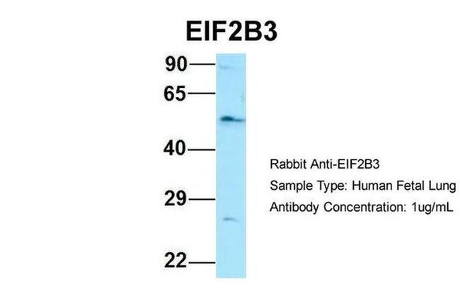 eIF2b gamma Antibody in Western Blot (WB)