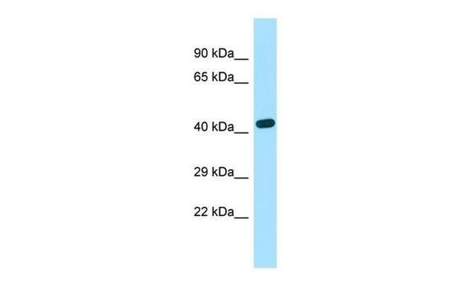 EXOC3L2 Antibody in Western Blot (WB)