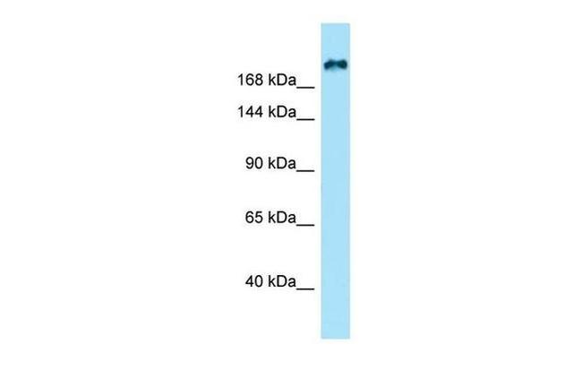 KIF21B Antibody in Western Blot (WB)