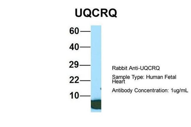 UQCRQ Antibody in Western Blot (WB)