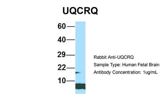 UQCRQ Antibody in Western Blot (WB)