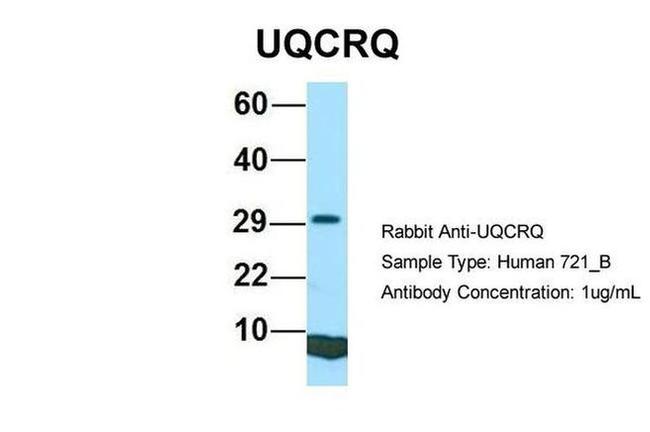 UQCRQ Antibody in Western Blot (WB)