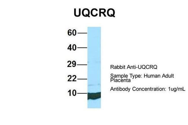 UQCRQ Antibody in Western Blot (WB)