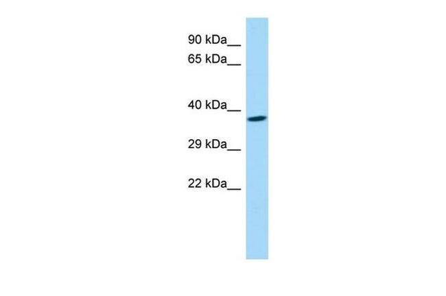 FAM108A1 Antibody in Western Blot (WB)