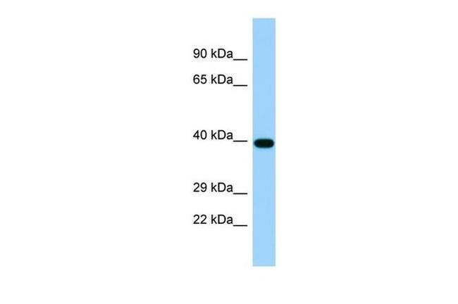 TICAM2 Antibody in Western Blot (WB)