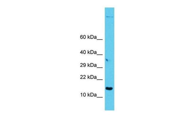 GAGE12I Antibody in Western Blot (WB)