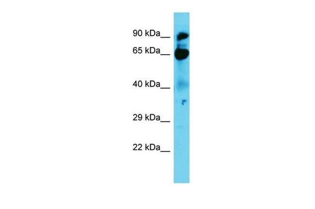 NOL9 Antibody in Western Blot (WB)