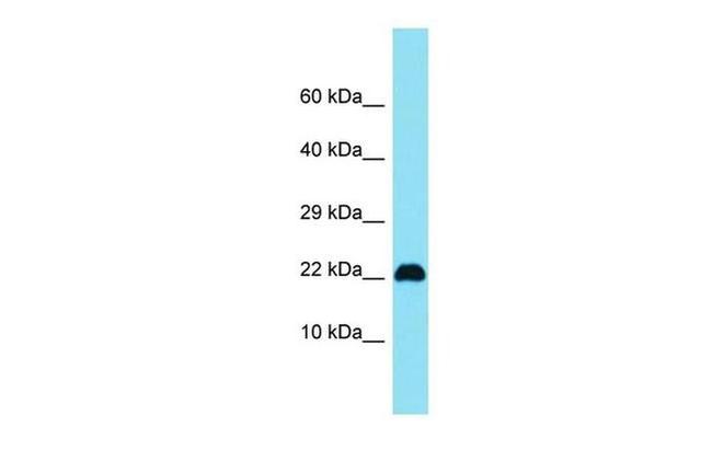 C15orf32 Antibody in Western Blot (WB)