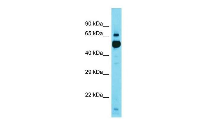 KBTBD11 Antibody in Western Blot (WB)
