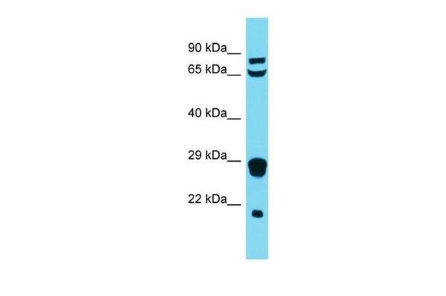 MRPL18 Antibody in Western Blot (WB)