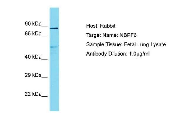 NBPF6 Antibody in Western Blot (WB)