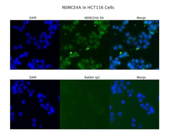 NSMCE4A Antibody in Immunocytochemistry (ICC/IF)