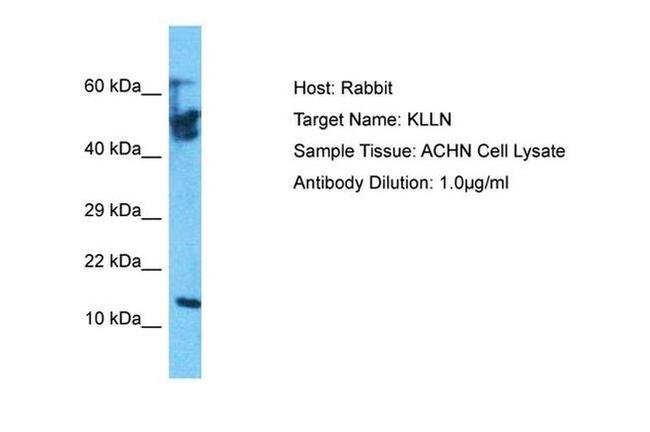 KLLN Antibody in Western Blot (WB)