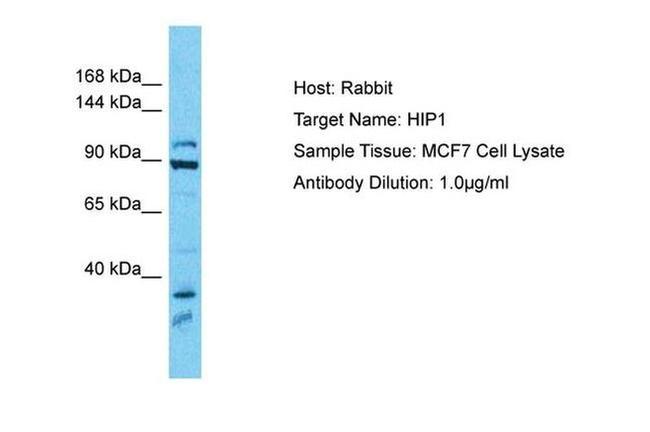 HIP1 Antibody in Western Blot (WB)