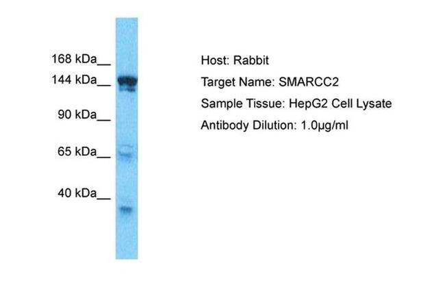 SMARCC2 Antibody in Western Blot (WB)