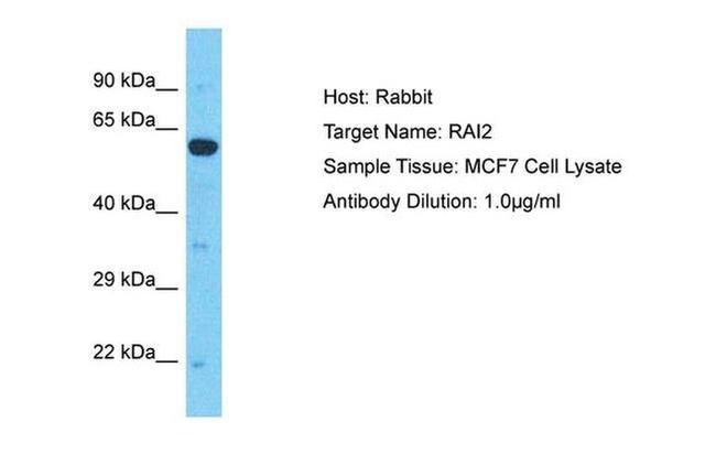 RAI2 Antibody in Western Blot (WB)