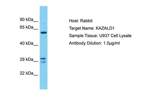 KAZALD1 Antibody in Western Blot (WB)